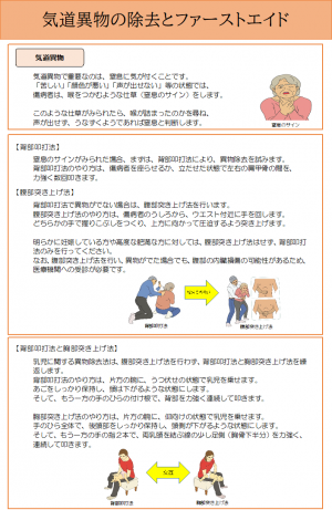 気道異物の除去とファーストエイド