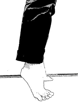 かかと上げ